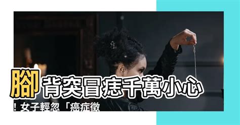 腳背突然長痣|有片／「這部位」長黑痣確診惡性黑色素癌 醫師警告別忽略它！